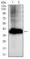 Mouse Monoclonal Antibody to AKR1C1