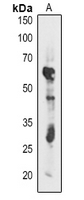Rabbit Polyclonal Antibody to atpB