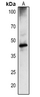 Rabbit Polyclonal Antibody to DEGP1