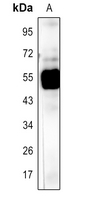 Rabbit Polyclonal Antibody to rbcL