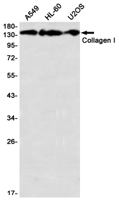 Rabbit Monoclonal Antibody to COL1A1