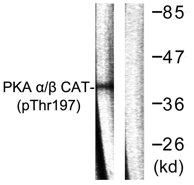 Rabbit Polyclonal Antibody to Phospho-PKA alpha/beta/gamma (Thr197)