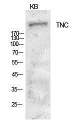Rabbit Polyclonal Antibody to TNC