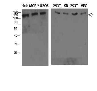 Rabbit Polyclonal Antibody to COL4A1