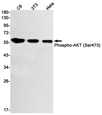 Rabbit Monoclonal Antibody to Phospho-AKT (Ser473)