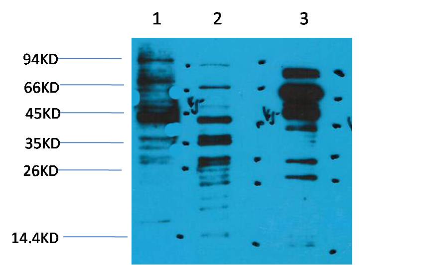 Rabbit Polyclonal Antibody to Acetyl-Lysine