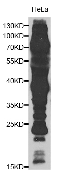 Rabbit Polyclonal Antibody to Acetyl-Lysine