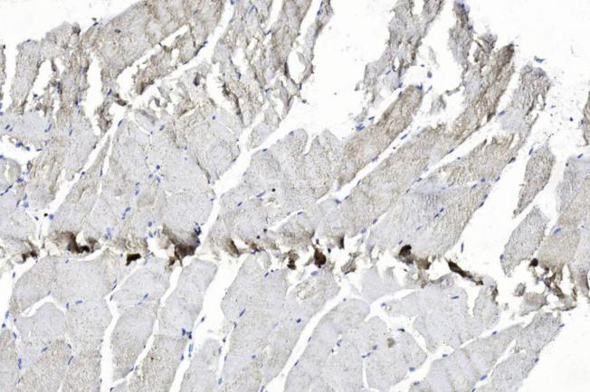 Mouse Polyclonal Antibody to EPHB2