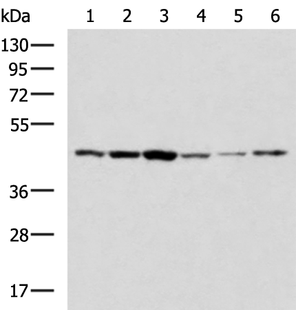 Rabbit Polyclonal Antibody to ACTB