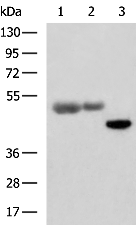 Rabbit Polyclonal Antibody to 6×His Tag