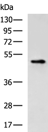 Rabbit Polyclonal Antibody to FLAG Tag