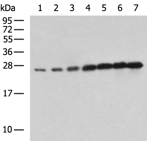 Rabbit Polyclonal Antibody to GFP