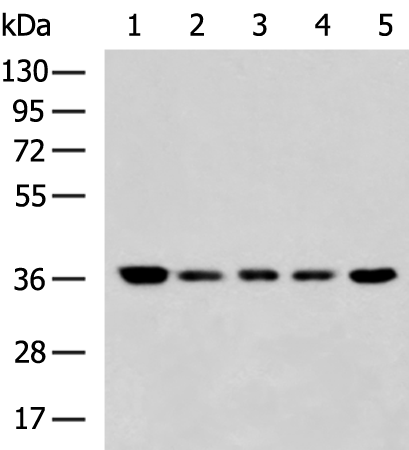 Rabbit Polyclonal Antibody to GAPDH