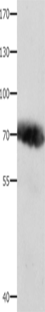 Rabbit Polyclonal Antibody to AFP