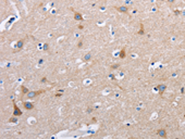 Rabbit Polyclonal Antibody to FN1