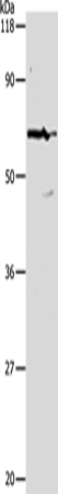 Rabbit Polyclonal Antibody to PKM