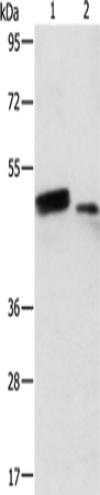 Rabbit Polyclonal Antibody to RARB