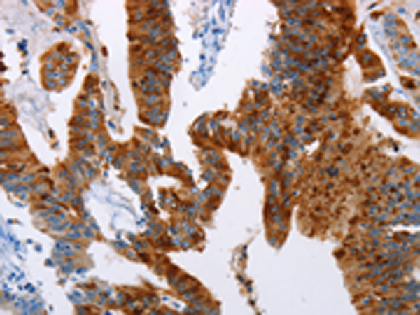 Rabbit Polyclonal Antibody to TFF3