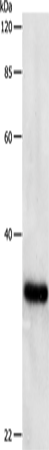 Rabbit Polyclonal Antibody to PCNA