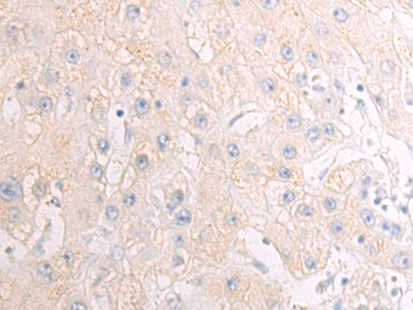 Rabbit Polyclonal Antibody to EPHX1