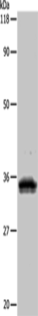Rabbit Polyclonal Antibody to UPK3B