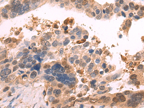 Rabbit Polyclonal Antibody to KLK3