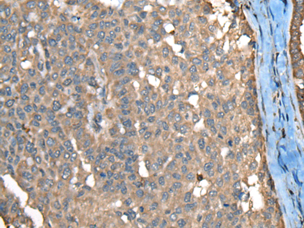 Rabbit Polyclonal Antibody to UBB