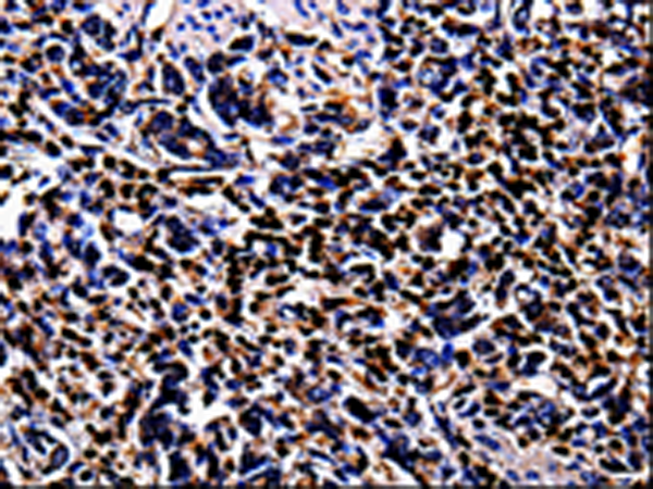Rabbit Polyclonal Antibody to S100A4