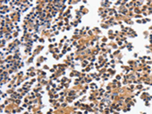 Rabbit Polyclonal Antibody to MAGEA4