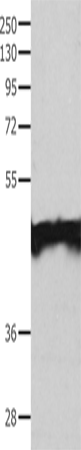 Rabbit Polyclonal Antibody to MAT1A