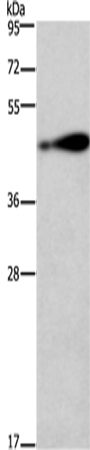 Rabbit Polyclonal Antibody to AGER