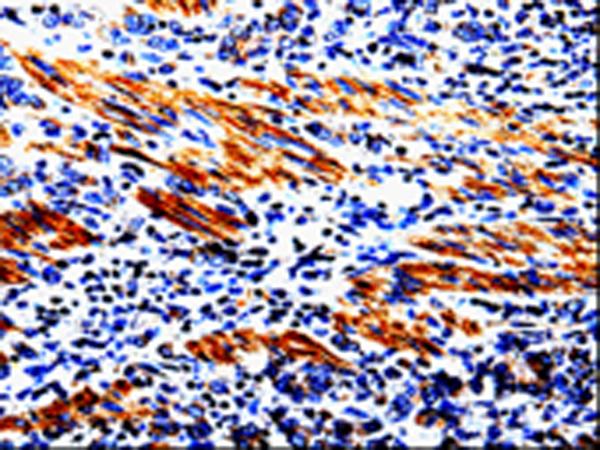 Rabbit Polyclonal Antibody to ACSBG2