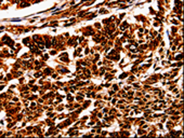 Rabbit Polyclonal Antibody to BOLL