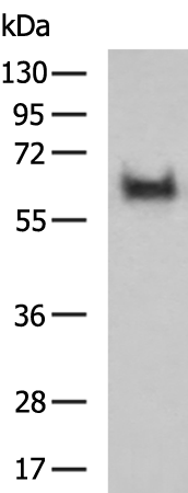 Rabbit Polyclonal Antibody to DAZ4