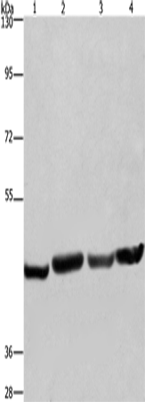 Rabbit Polyclonal Antibody to RBMY1A1