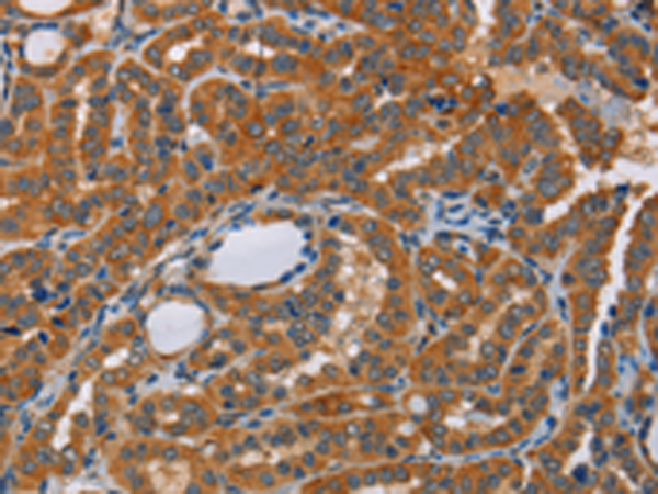 Rabbit Polyclonal Antibody to KRT13