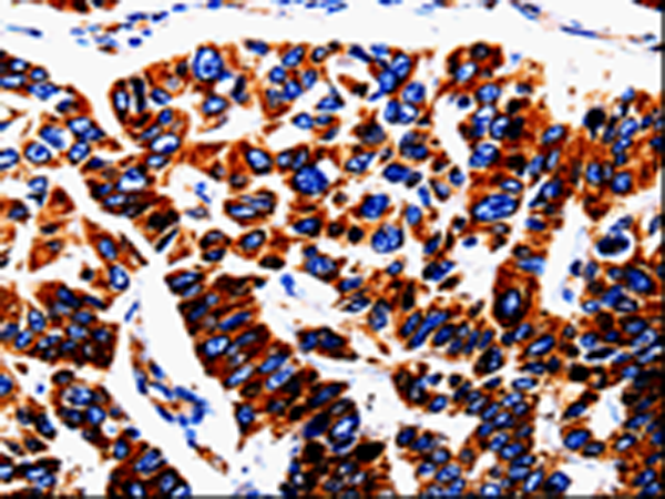 Rabbit Polyclonal Antibody to UTS2