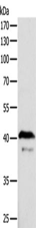 Rabbit Polyclonal Antibody to ADAP1