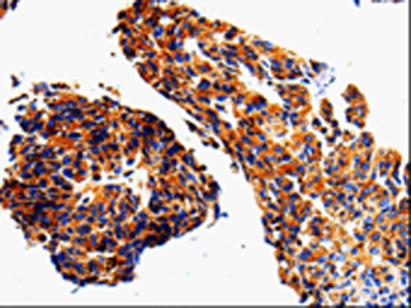 Rabbit Polyclonal Antibody to ADD1