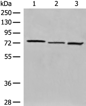 Rabbit Polyclonal Antibody to AFP