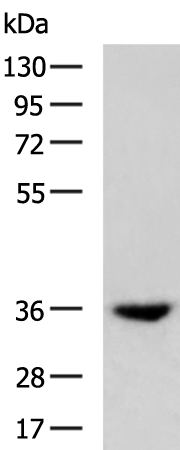 Rabbit Polyclonal Antibody to AKR1B1