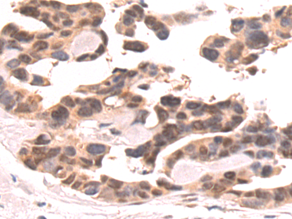 Rabbit Polyclonal Antibody to AKT1