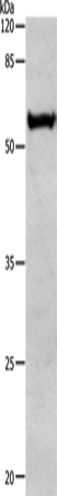 Rabbit Polyclonal Antibody to ALDH1A1/ALDH1A2/ALDH1A3