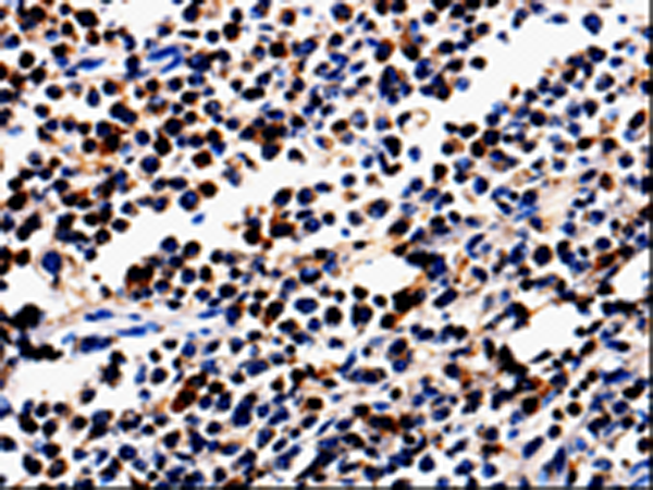 Rabbit Polyclonal Antibody to ALOX5