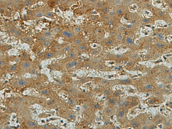Rabbit Polyclonal Antibody to ALPL