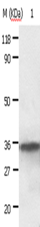 Rabbit Polyclonal Antibody to ANXA2