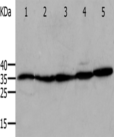Rabbit Polyclonal Antibody to ANXA5