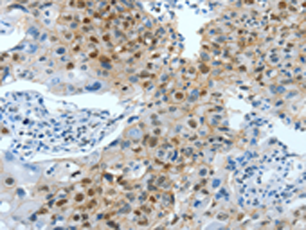 Rabbit Polyclonal Antibody to JUN