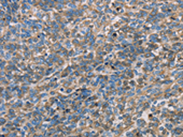 Rabbit Polyclonal Antibody to APOA1