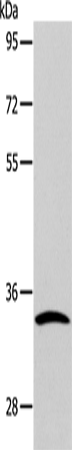 Rabbit Polyclonal Antibody to CASP6